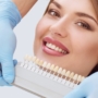 Λεύκανση δοντιών: Ανανεώστε το χαμόγελό σας μέσα σε μία ώρα!
